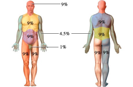 Rule of Nine for Adults:
Anterior side of body:
Head and neck 9%
Upper Thorax 9%
Lower Thorax 9%
Right Leg 9%
Left Leg 9%
Right Arm 4.5%
Left Arm 4.5%
Perineum 1%

Poster side of body:
Head and neck 9%
Upper Thorax 9%
Lower Thorax 9%
Right Leg 9%
Left Leg 9%
Right Arm 4.5%
Left Arm 4.5%
