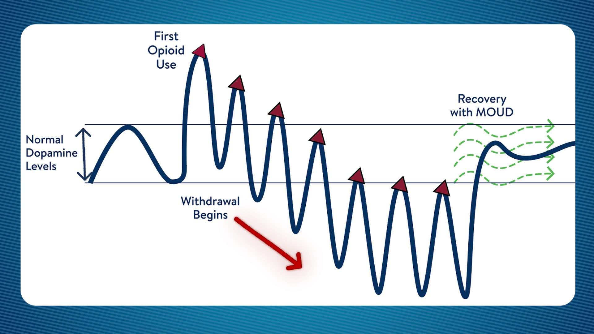 Chart showing how dopamine levels in the brain are affected by withdrawal.