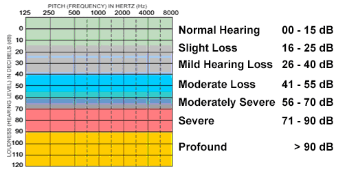 Diagram representing the degree of loss measured in decibels.