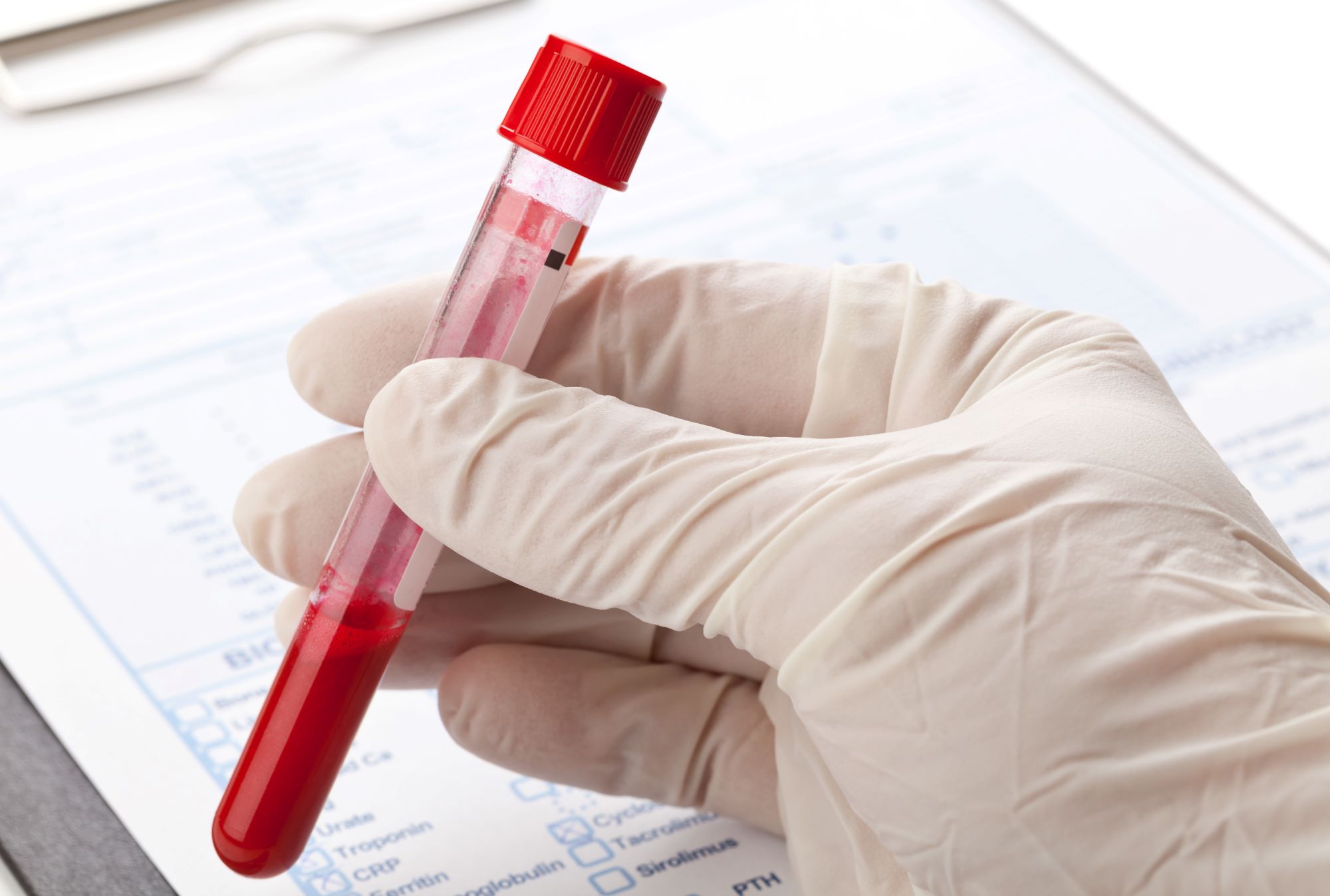 blood sample